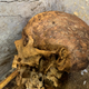 The skull, with patches of gray hair and portions of a left ear still visible.